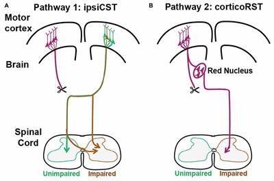 Plasticity in One Hemisphere, Control From Two: Adaptation in Descending Motor Pathways After Unilateral Corticospinal Injury in Neonatal Rats